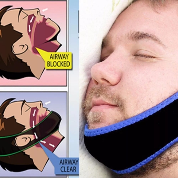 Anti Snoring Strap Package $10 for packag - Picture 4 of 5